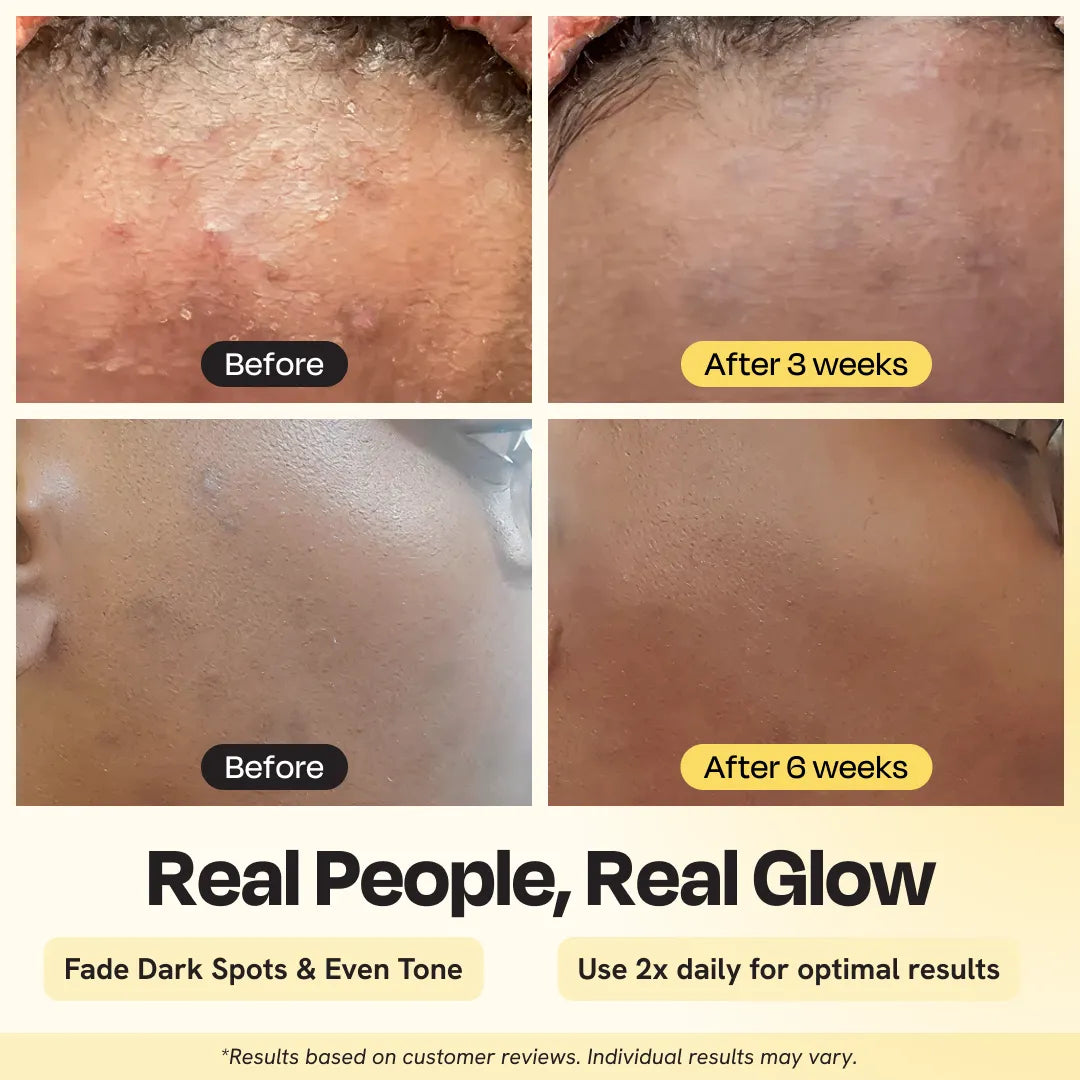 Gleamin Advanced Brightening Moisturizer
