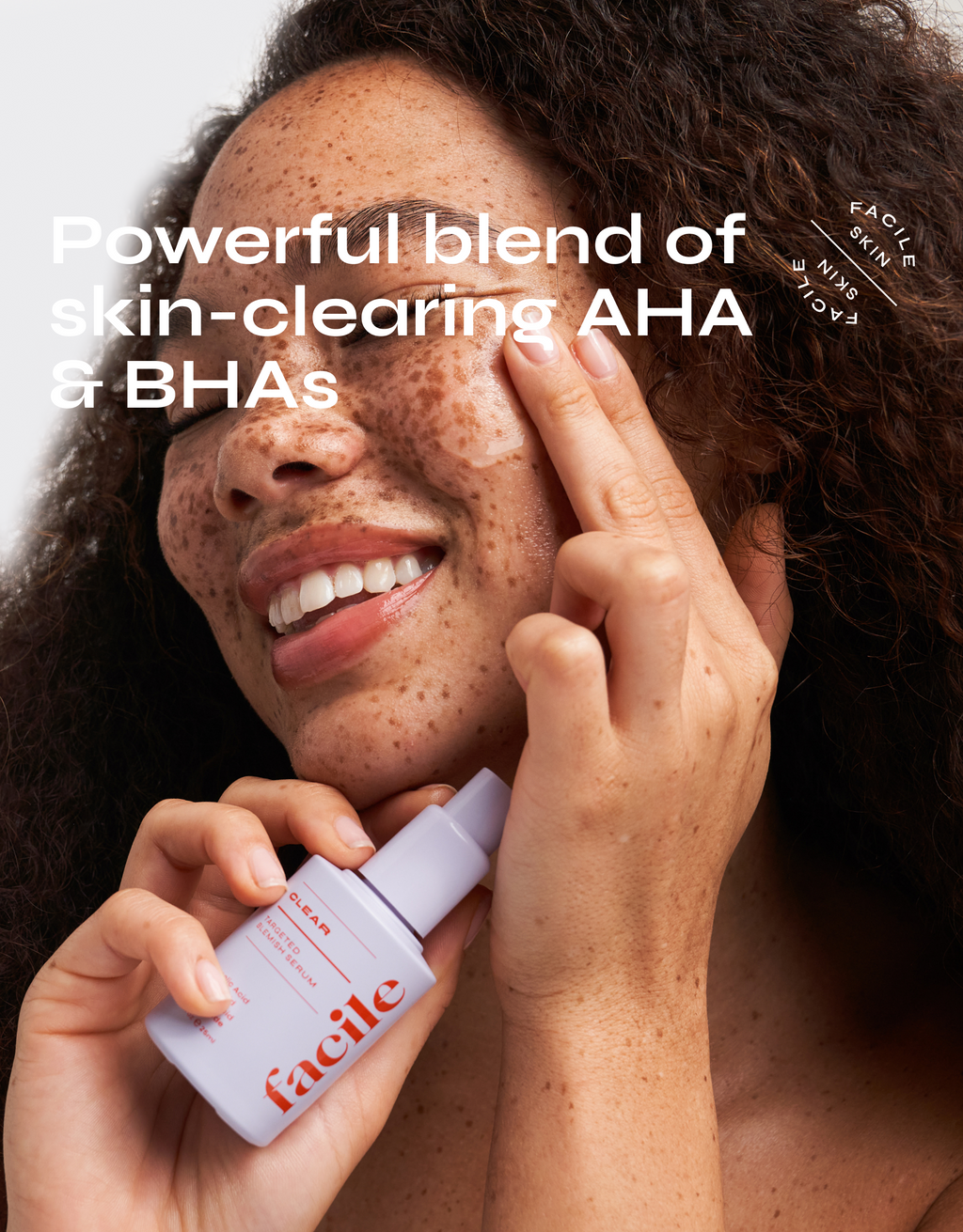 Facile Acne-Clearing Treatment