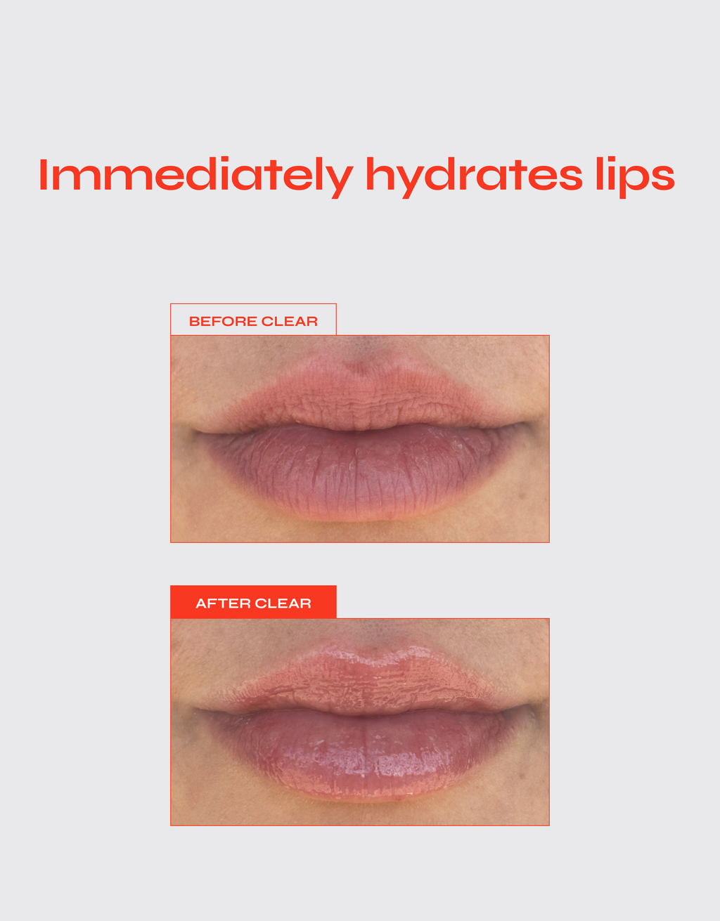 Facile Hydrating Lip Jelly