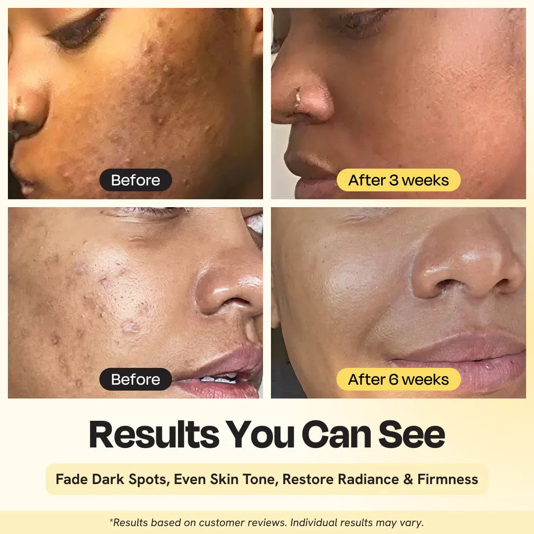 Gleamin Superactive Vitamin C Serum
