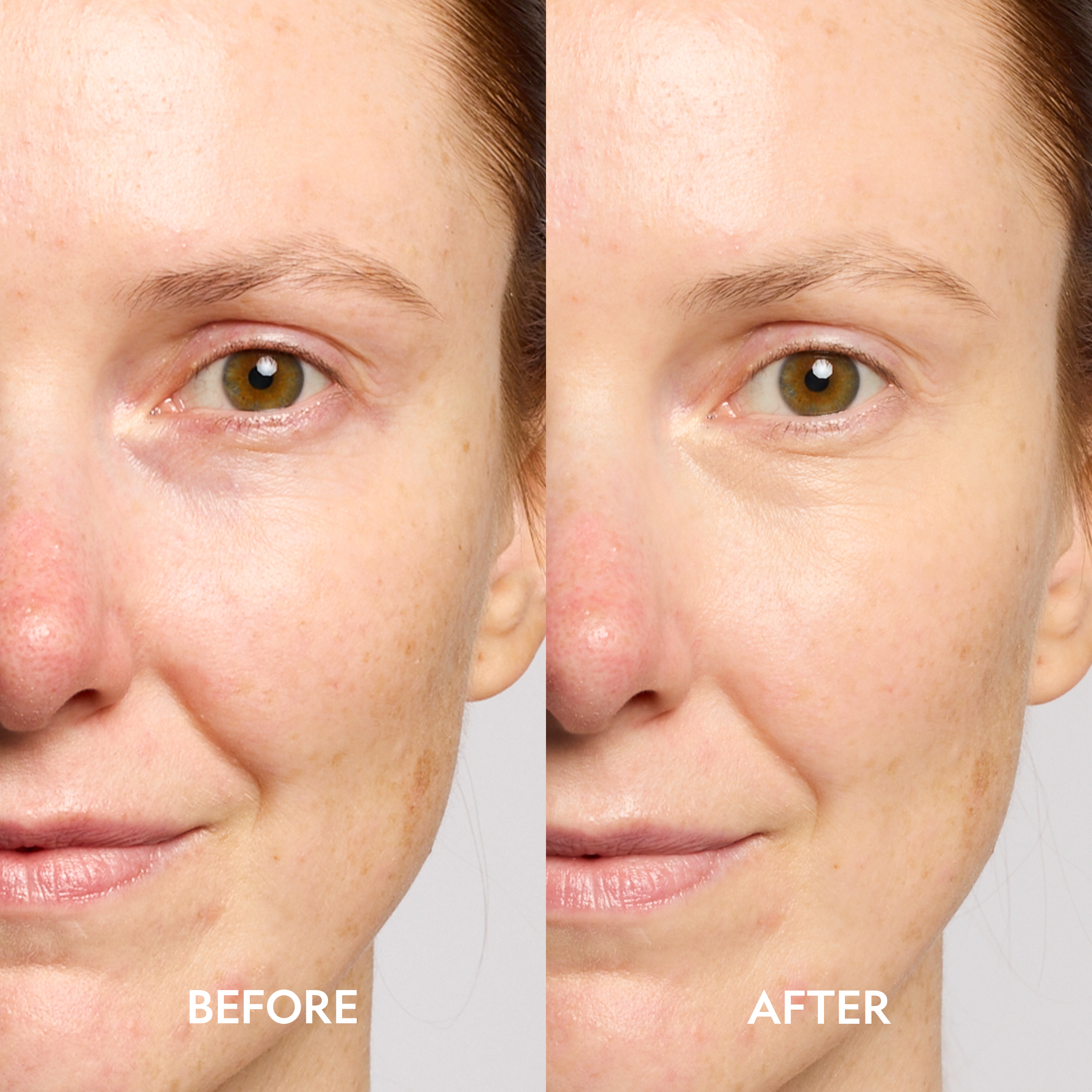 YENSA Super Bright Dark Circle Eye Serum