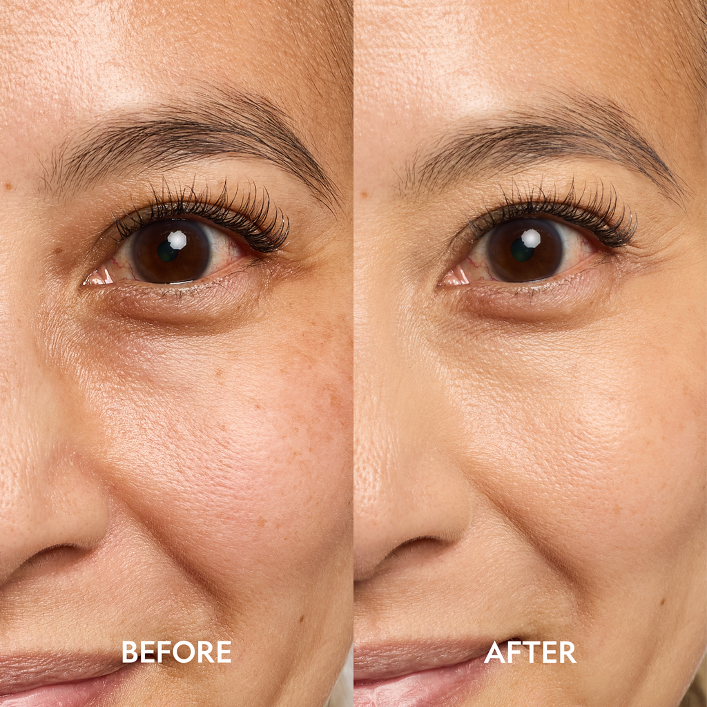 YENSA Super Bright Dark Circle Eye Serum